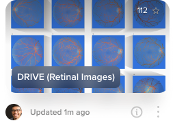 DRIVE (Retinal Images) dataset visualization on Activeloop Platform