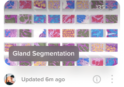 Gland Segmentation dataset visualization on Activeloop Platform