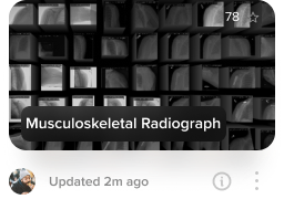 Musculoskeletal Radiograph dataset visualization on Activeloop Platform